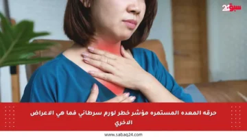 حرقة المعدة المستمرة مؤشر خطر لورم سرطاني فما هي الأعراض الأخرى